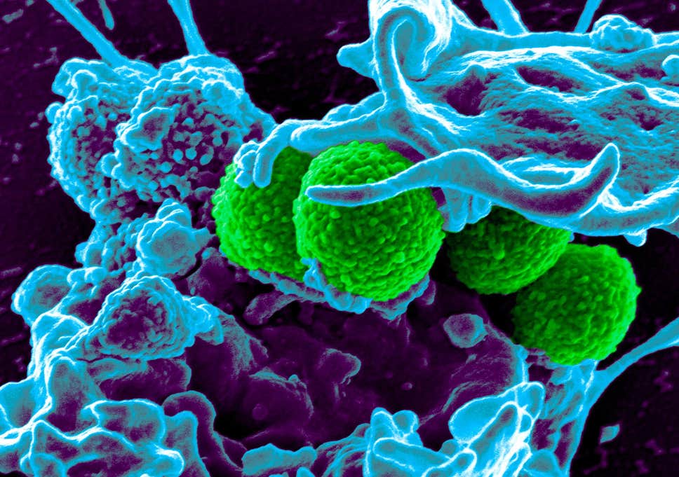 Superbugs