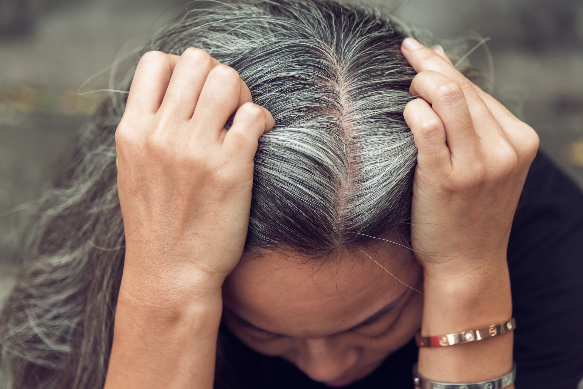 Why Tension does your hair gray : Researchers made noticed