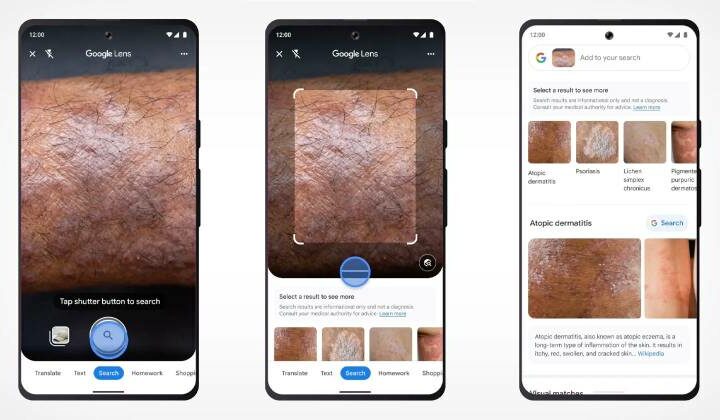 You can now look up skin conditions using Google Lens