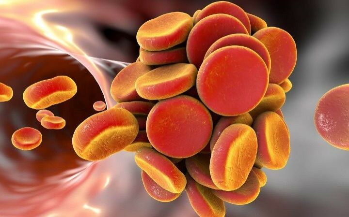 5 Diseases That May Affect Your Platelet Count